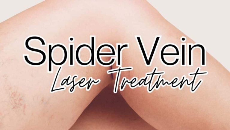 Say Goodbye to Unsightly Veins with ND: YAG Spider Vein Treatments at Taylor Drive Facial Aesthetics.